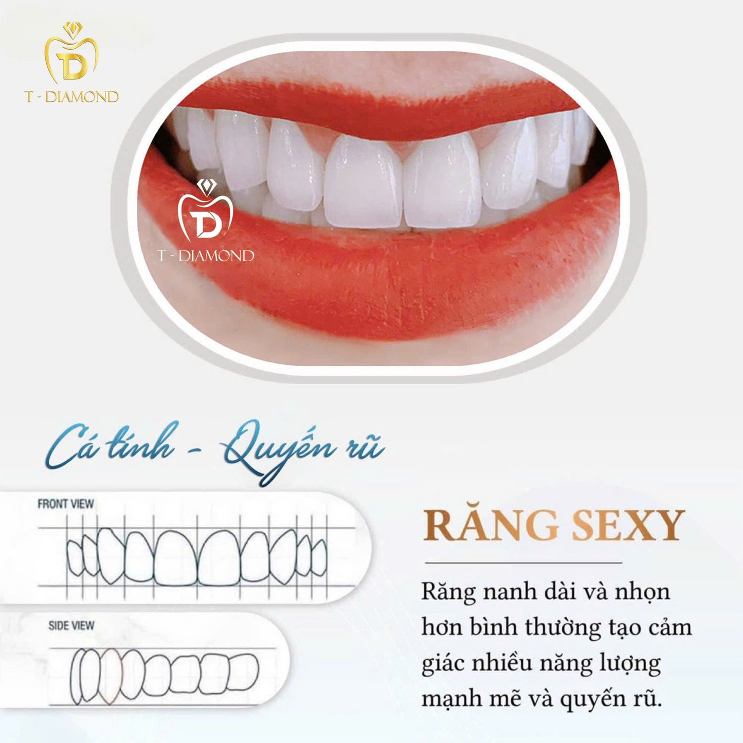 Cercon HT Porcelain Teeth