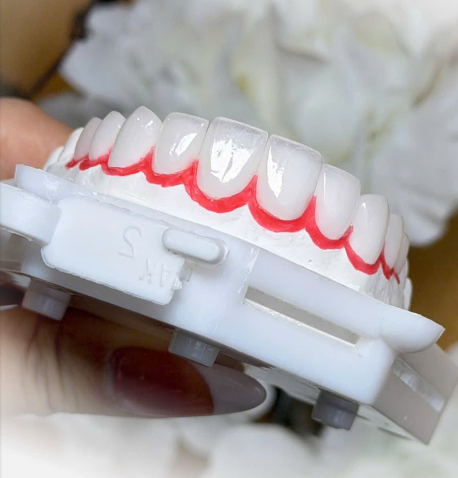 Bọc Sứ Thẩm Mỹ