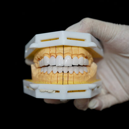 Cercon HT Porcelain Teeth