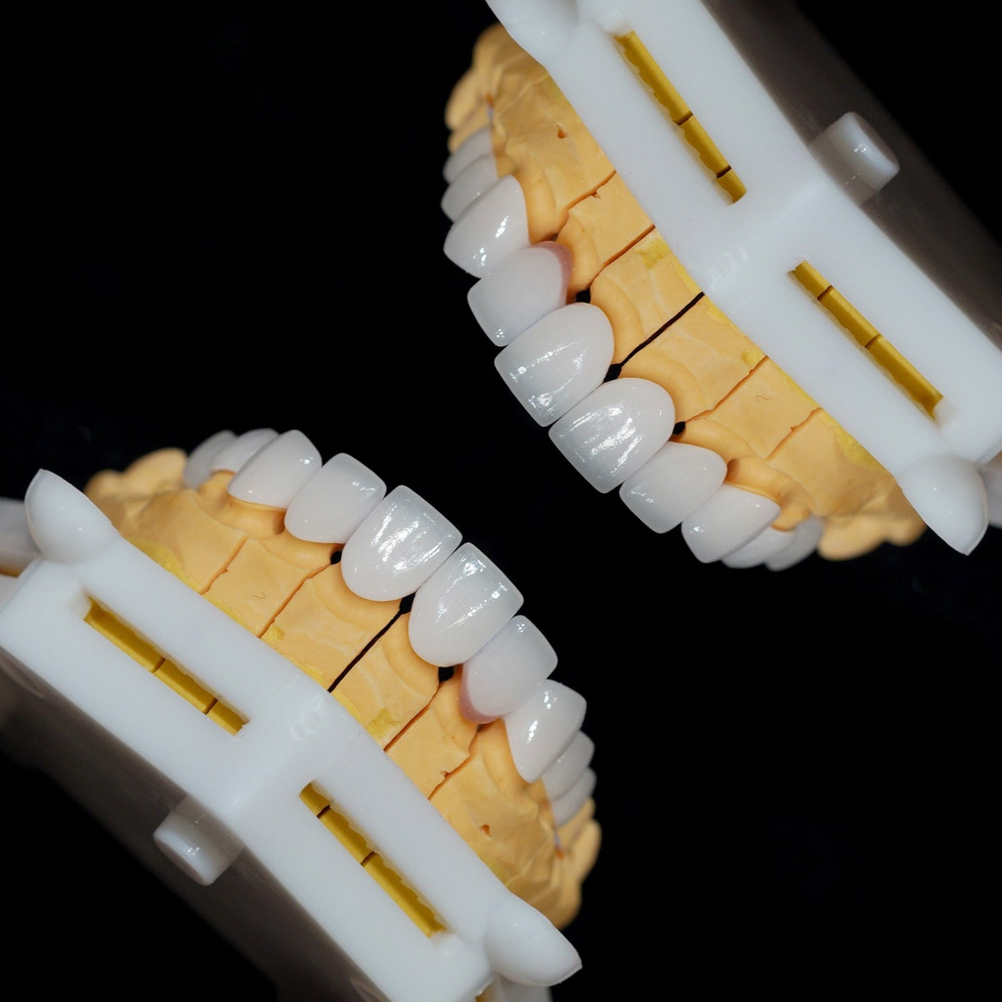 Cercon HT Porcelain Teeth