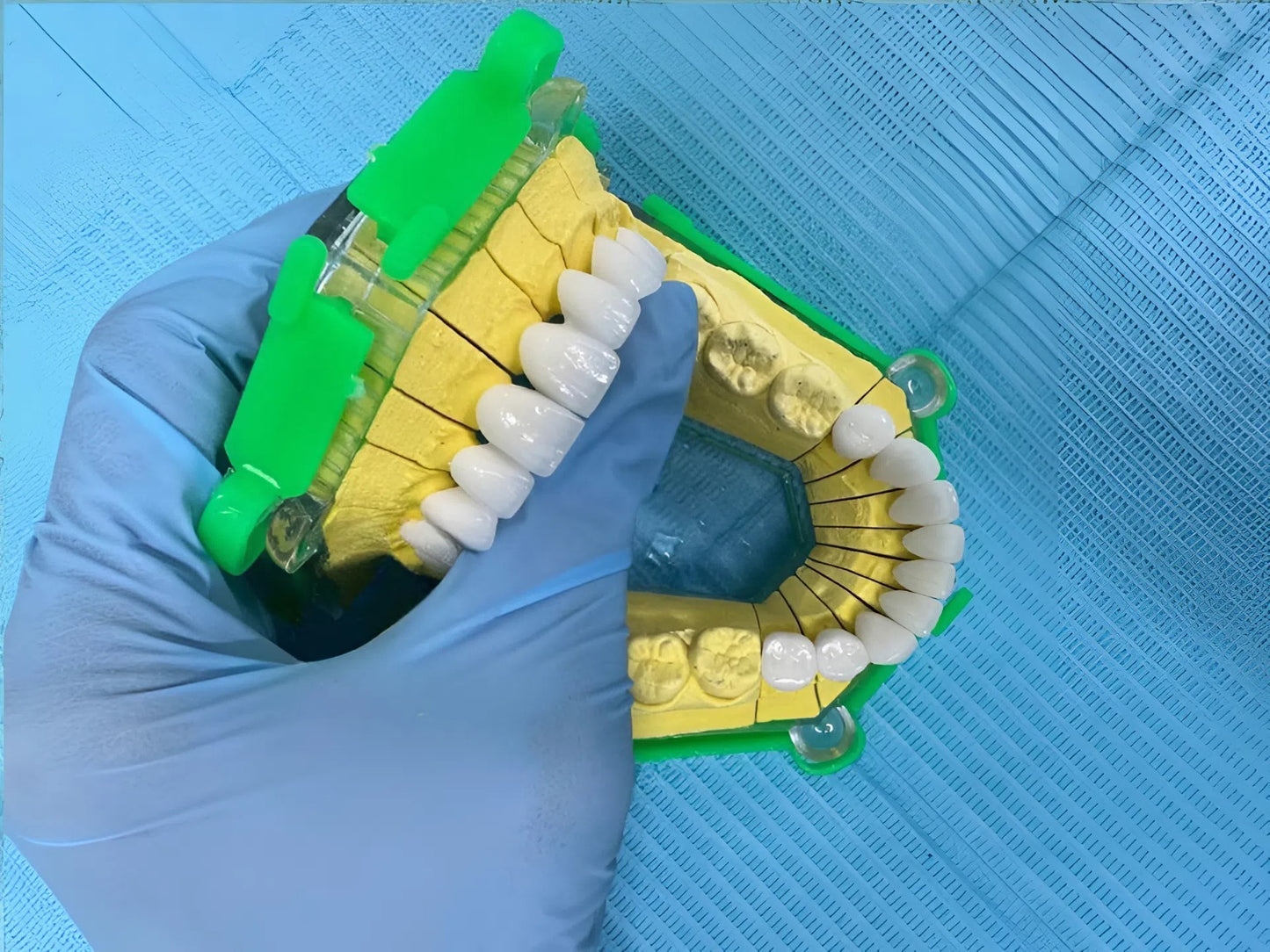 Lava Plus Crowns