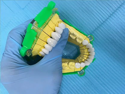 Lava Plus Crowns