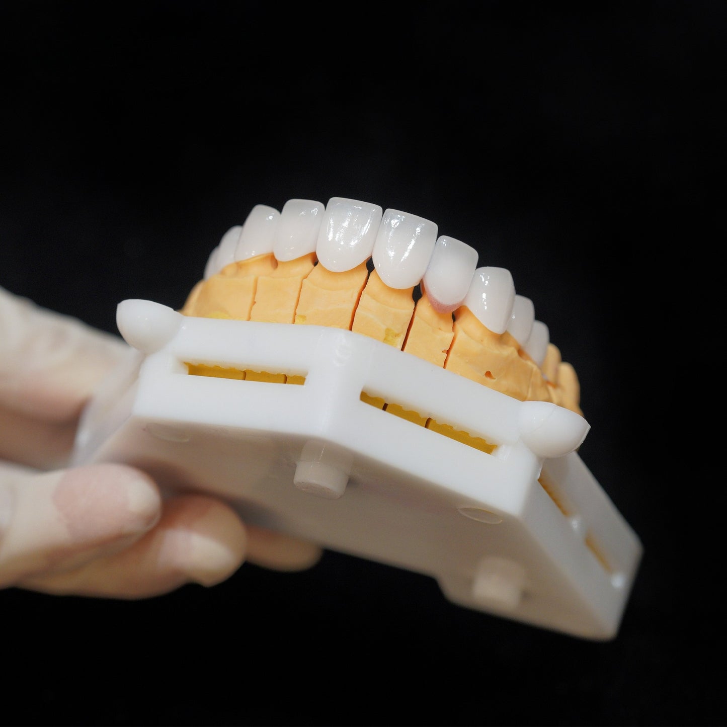Cercon HT Porcelain Teeth