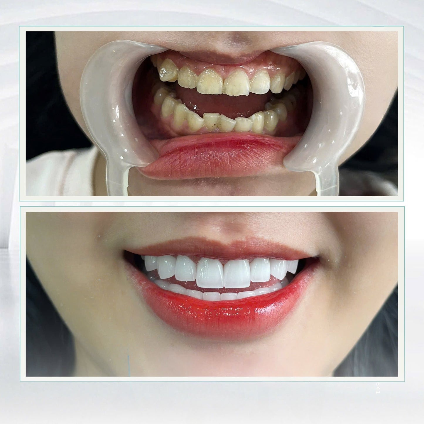 Lava Plus Crowns