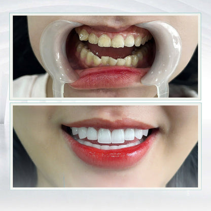 Lava Plus Crowns