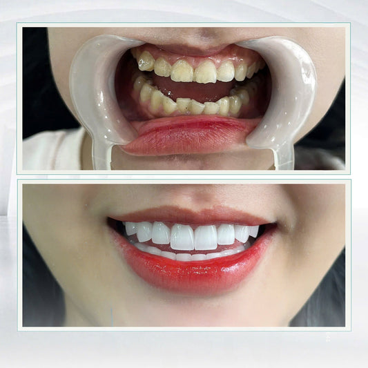 Lava Plus Crowns