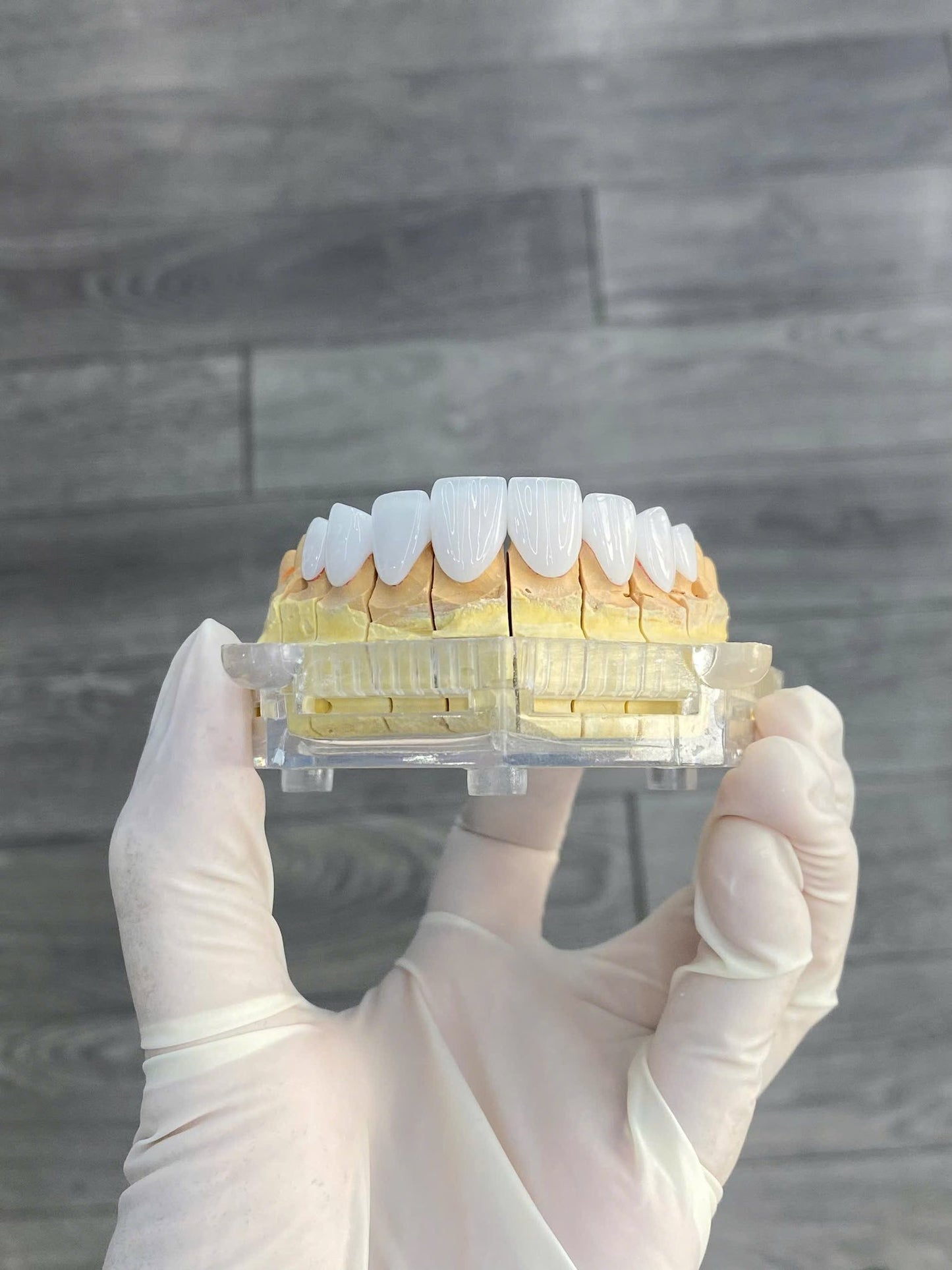 Cercon HT Porcelain Teeth