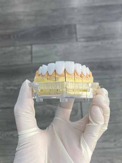 Cercon HT Porcelain Teeth