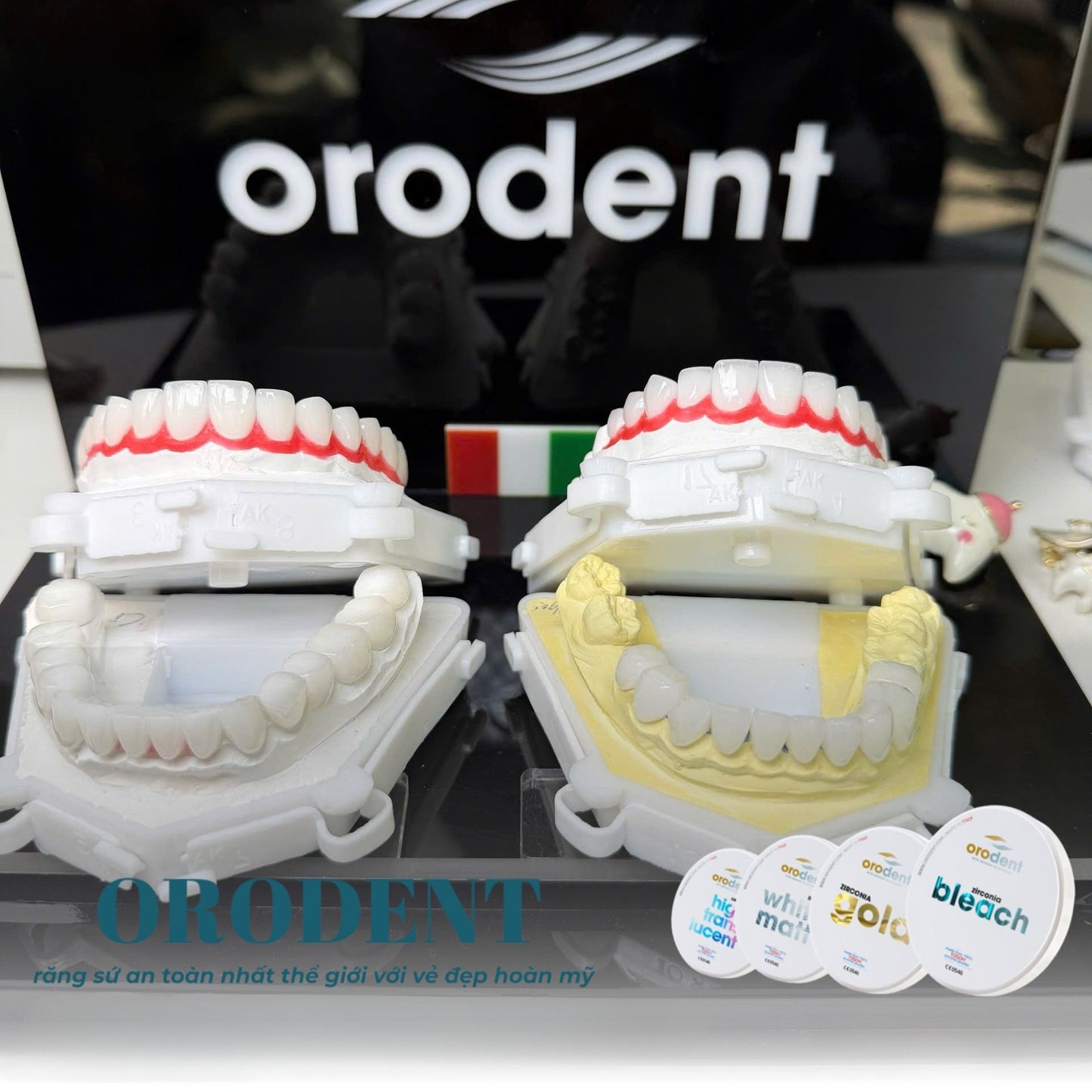 Răng Sứ Cao Cấp ORODENT