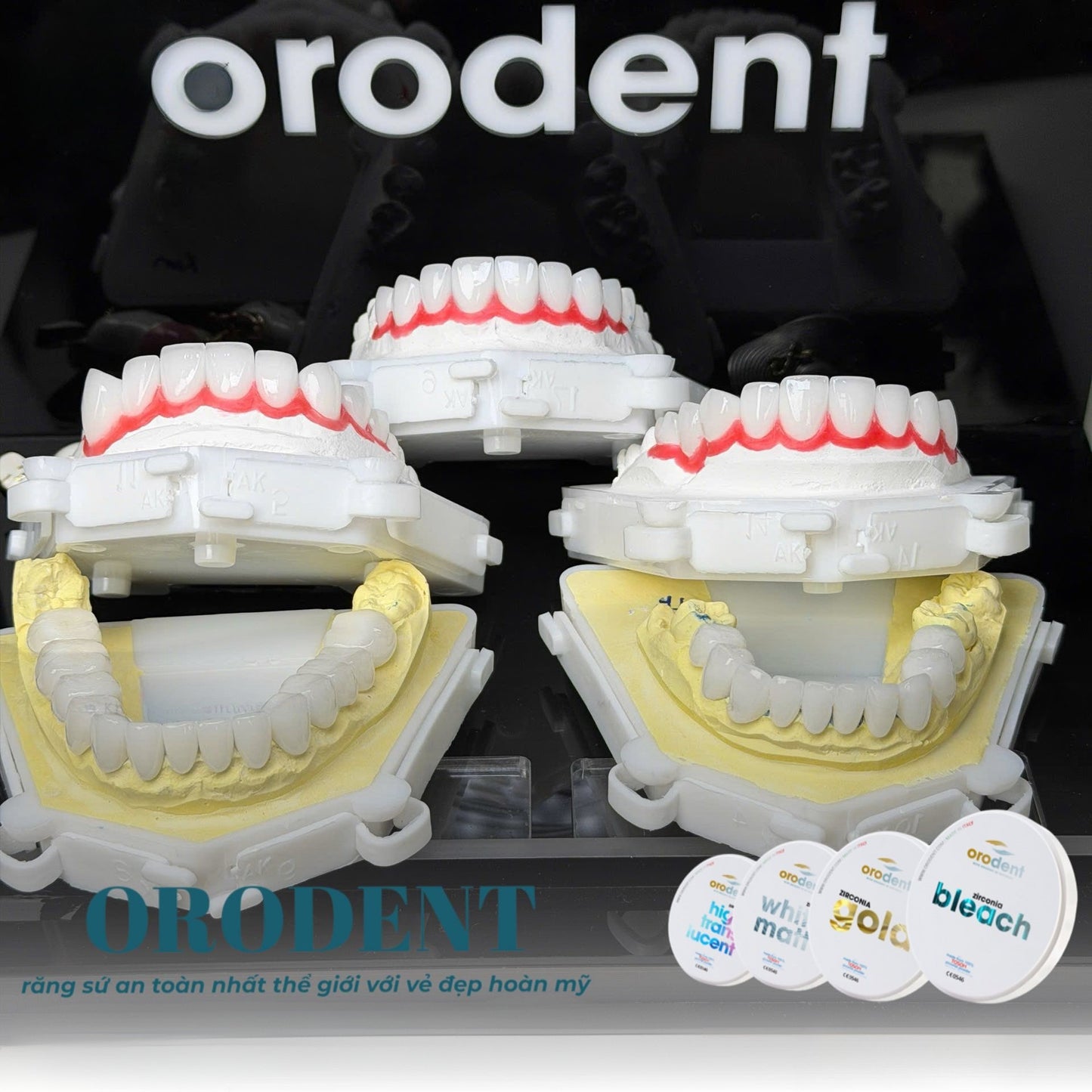 Răng Sứ Cao Cấp ORODENT