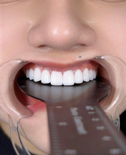 Răng Sứ Zirconia