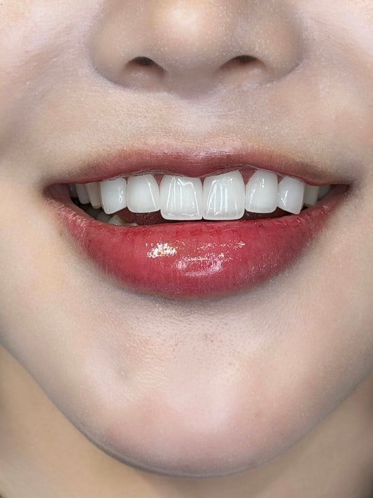 Zirconia Dental Crowns