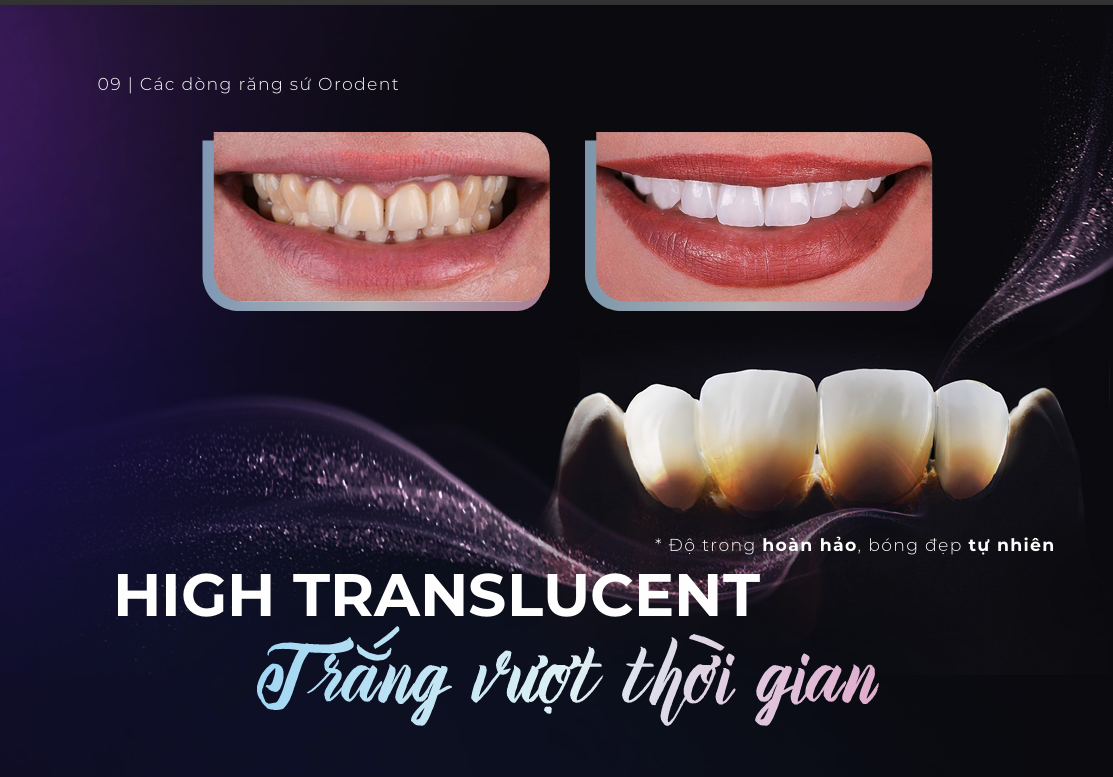 Răng Sứ Cao Cấp ORODENT