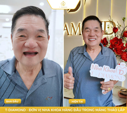 Complete removable denture