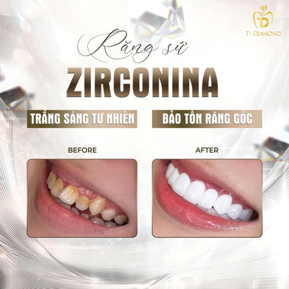 Răng Sứ Zirconia